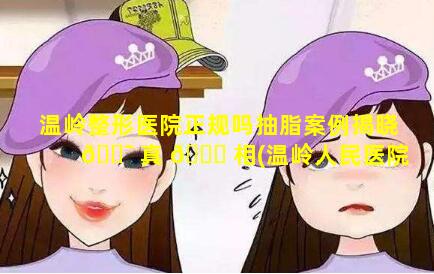 温岭整形医院正规吗抽脂案例揭晓 🐯 真 🍀 相(温岭人民医院整形美容科价格)